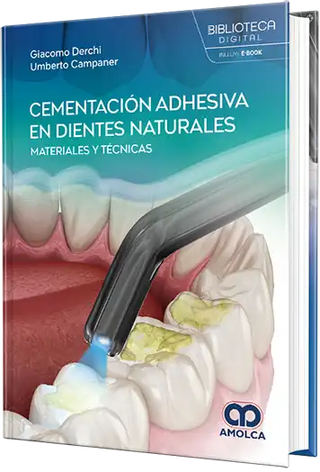 Cementación adhesiva en dientes naturales. Materiales y técnicas