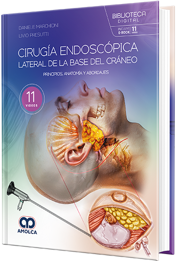 Cirugía endoscópica lateral de la base del cráneo. Principios, anatomía y abordajes