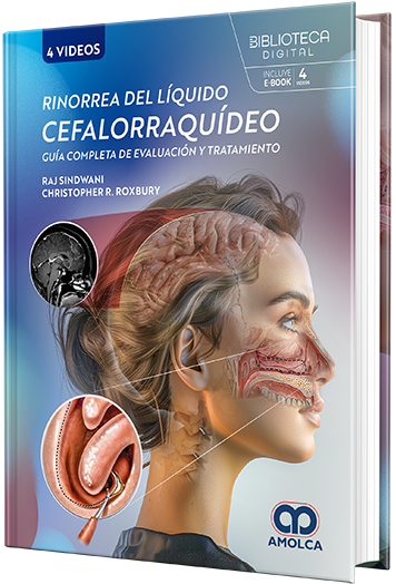 Rinorrea del líquido cefalorraquídeo. Guía completa de evaluación y tratamiento