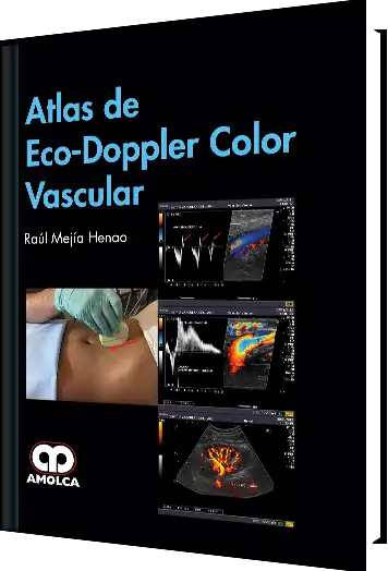 Atlas de Eco-Doppler Color Vascular