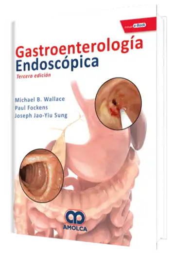 Gastroenterología Endoscópica 3 Edición
