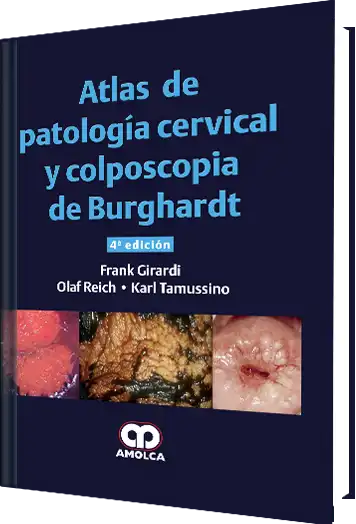 Atlas de Patología Cervical y Colposcopia de Burghardt 4 edición