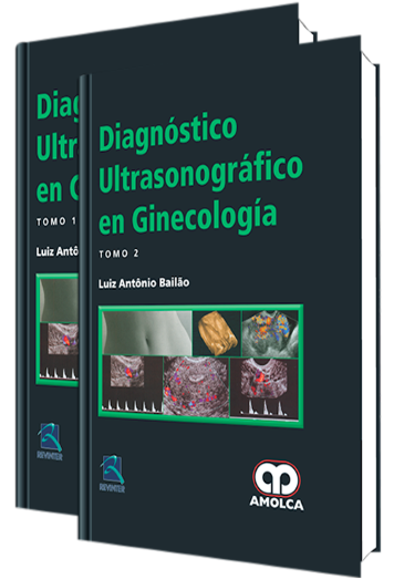 Diagnóstico Ultrasonográfico en Ginecología