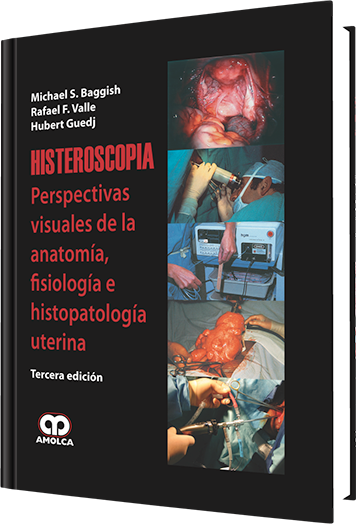 Histeroscopia. 3 edición