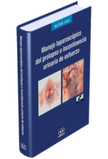 Manejo Laparoscópico del Prolapso e Incontinencia Urinaria de Esfuerzo