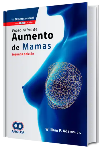 Video Atlas de Aumento de Mamas. 2 edición