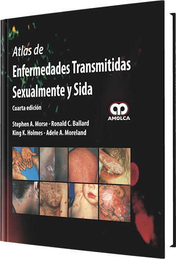Atlas de Enfermedades Transmitidas Sexualmente y Sida. 4 Edición