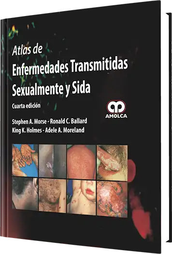 Atlas de Enfermedades Transmitidas Sexualmente y Sida. 4 Edición