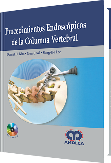 Procedimientos Endoscópicos de la Columna Vertebral