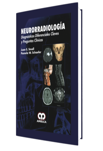 Neurorradiología