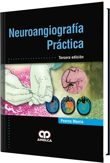 Neuroangiografía Práctica. 3 Edición