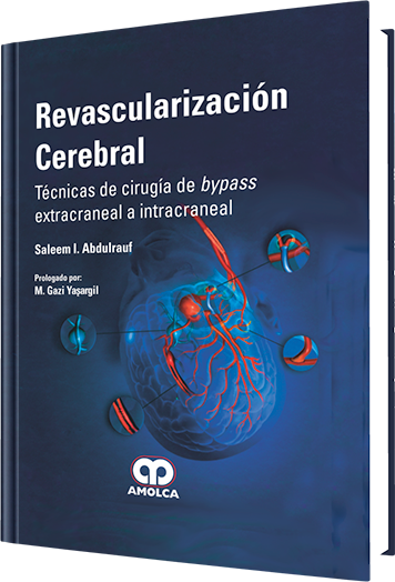 Revascularización Cerebral. Técnicas de Cirugía de Bypass Extracraneal  a Intracraneal