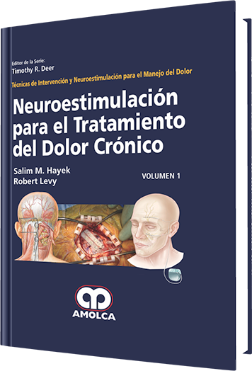 Neuroestimulación para el Tratamiento del Dolor Crónico Volumen 1