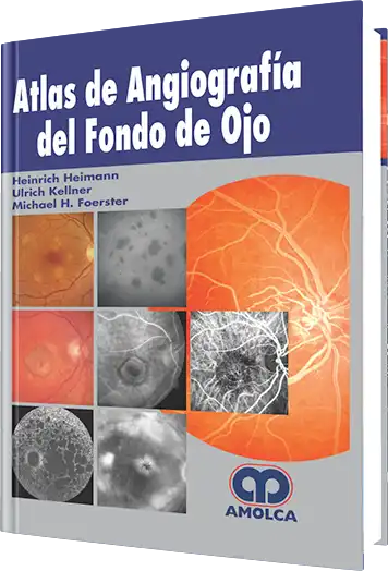 Atlas de Angiografía del Fondo de Ojo