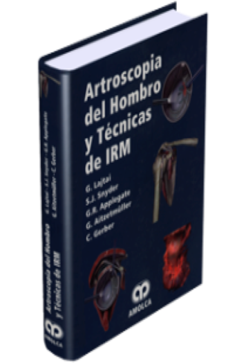 Artroscopia del Hombro y Técnicas de IRM