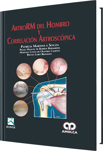 ArtroRM del Hombro y Correlación Artroscópica