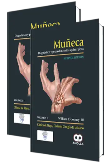 Muñeca. Diagnóstico y Procedimientos Quirúrgicos. 2 Edición
