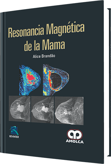 Resonancia Magnética de la Mama