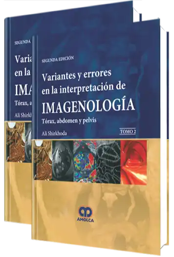 Variantes y Errores en la Interpretación de Imagenología 2 Edición