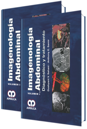 Imagenología Abdominal, Diagnóstico y Tratamiento