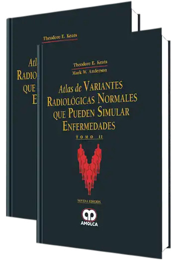 Atlas de Variantes Radiológicas Normales que Pueden Simular Enfermedades. 9 Edición