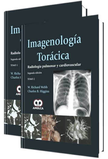 Imagenología Torácica.  Radiología Pulmonar y Cardiovascular 2 Edición