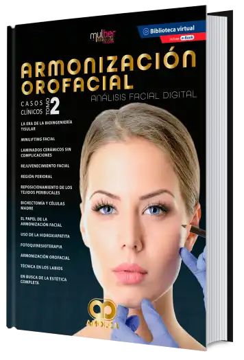 Armonización Orofacial. Análisis Facial Digital. Casos Clínicos, Tomo 2