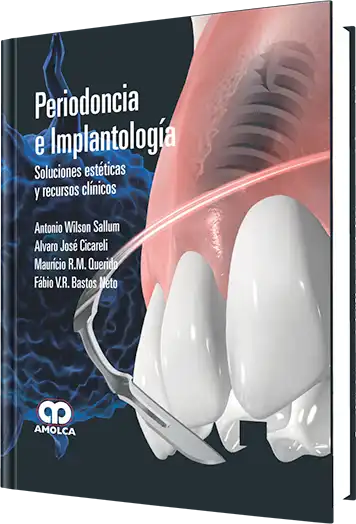 Periodoncia e Implantología