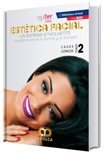 Estética Facial. La Sonrisa Envolvente. Equilibrio Entre la Forma y la Función. Casos Clínicos, Tomo 2