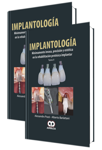 Implantología