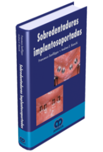 Sobredentaduras Implantosoportadas