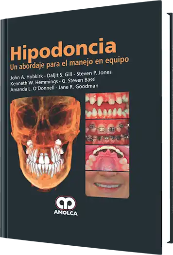 Hipodoncia