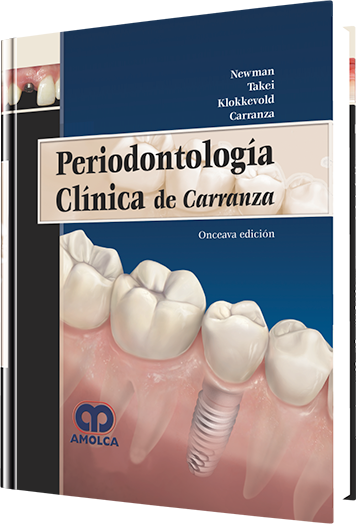 Periodontología Clínica de Carranza. 11 Edición