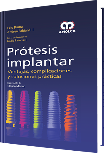 Prótesis Implantar