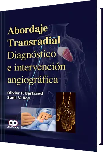 Abordaje Transradial Diagnóstico e Intervención Angiográfica