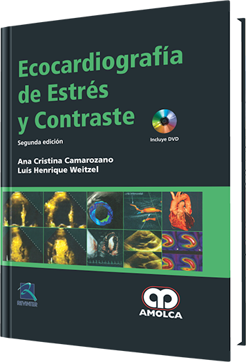 Ecocardiografía de Estrés y Contraste 2 edición