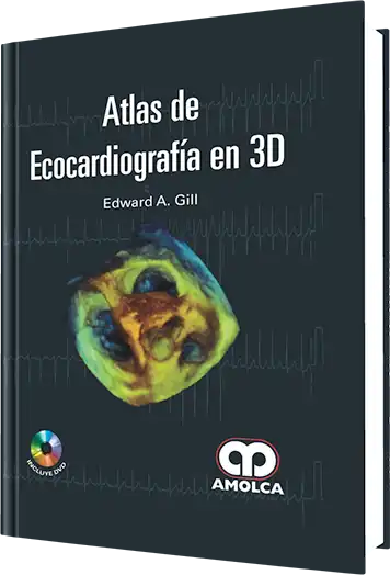 Atlas de Ecocardiografía en 3D