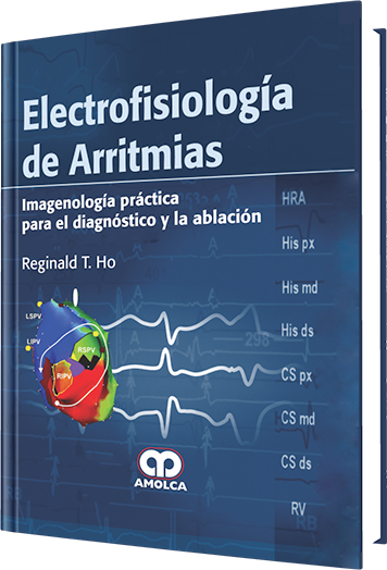 Electrofisiología de Arritmias