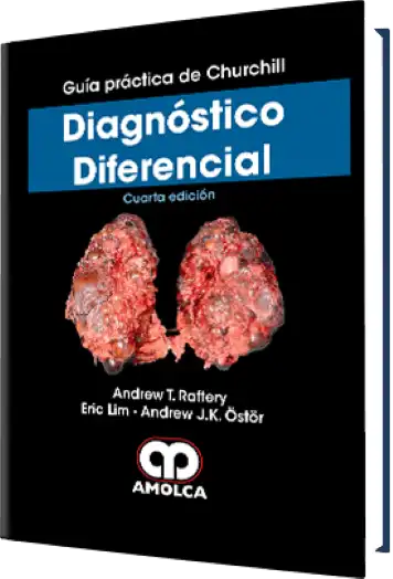 Guía práctica de Churchill Diagnóstico Diferencial 4 edición
