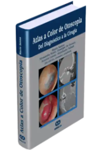 Atlas a Color de Otoscopia