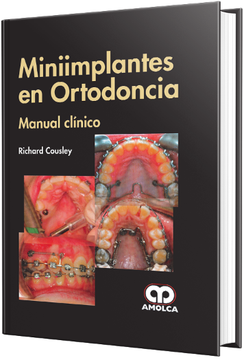 Miniimplantes en Ortodoncia Manual Clínico
