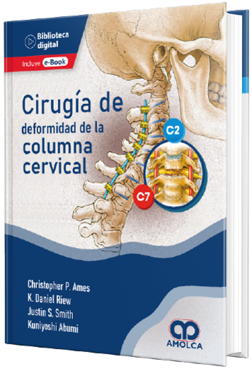 Cirugía de deformidad de la Columna Cervical