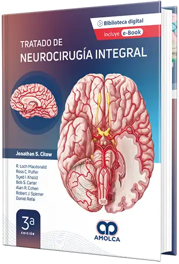 Tratado de neurocirugía integral, 3a Edición