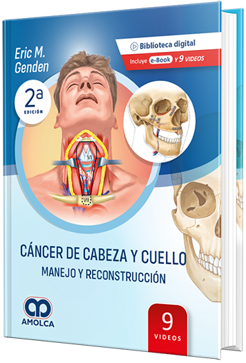 Cáncer de Cabeza y Cuello - Manejo y Reconstrucción