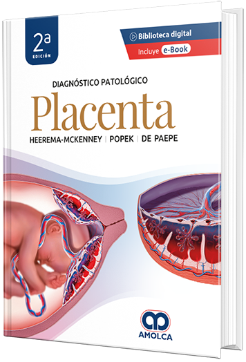 Diagnóstico patológico: Placenta. 2a Edición