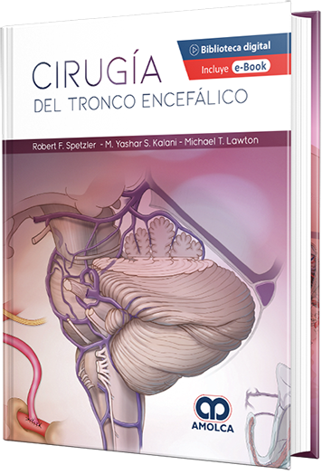 Cirugía del tronco encefálico